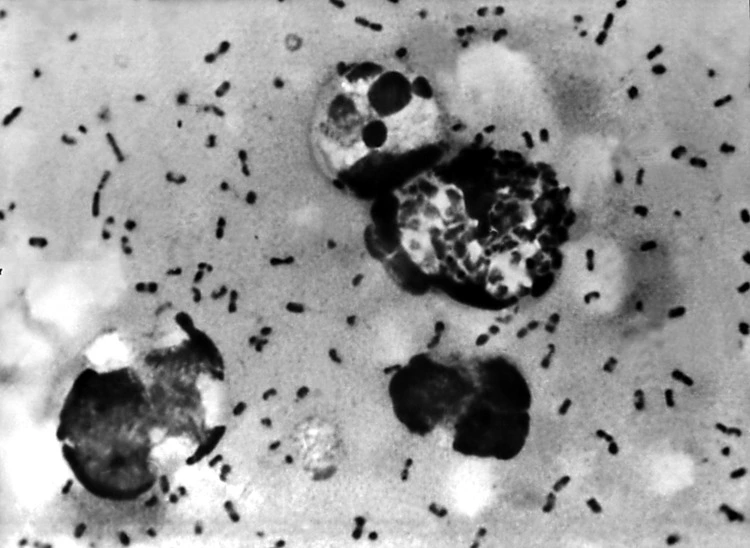 Yersinia pestis bacteria which caused Bubonic Plague. Yersinia pestis bacteria which caused Bubonic Plague. Yersinia pestis bacteria which caused Bubonic Plague.